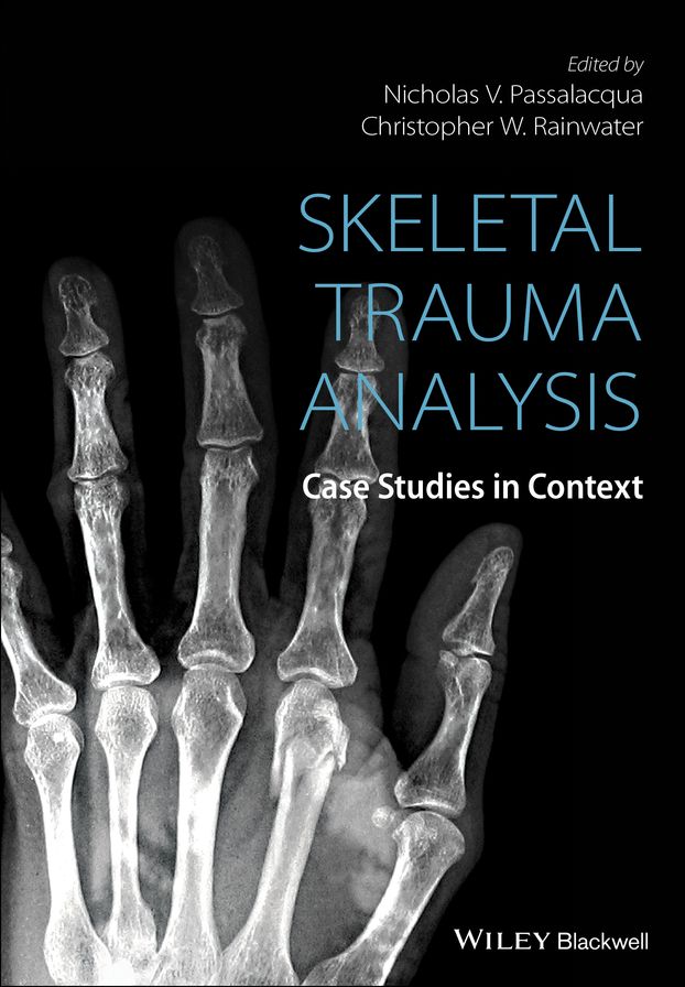 Skeletal Trauma Analysis: Case Studies in Context