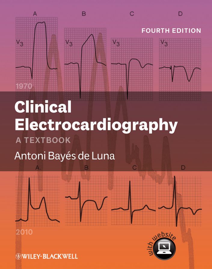 Clinical Electrocardiography: A Textbook