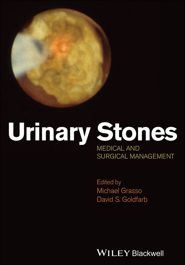 Urinary Stones: Medical and Surgical Management