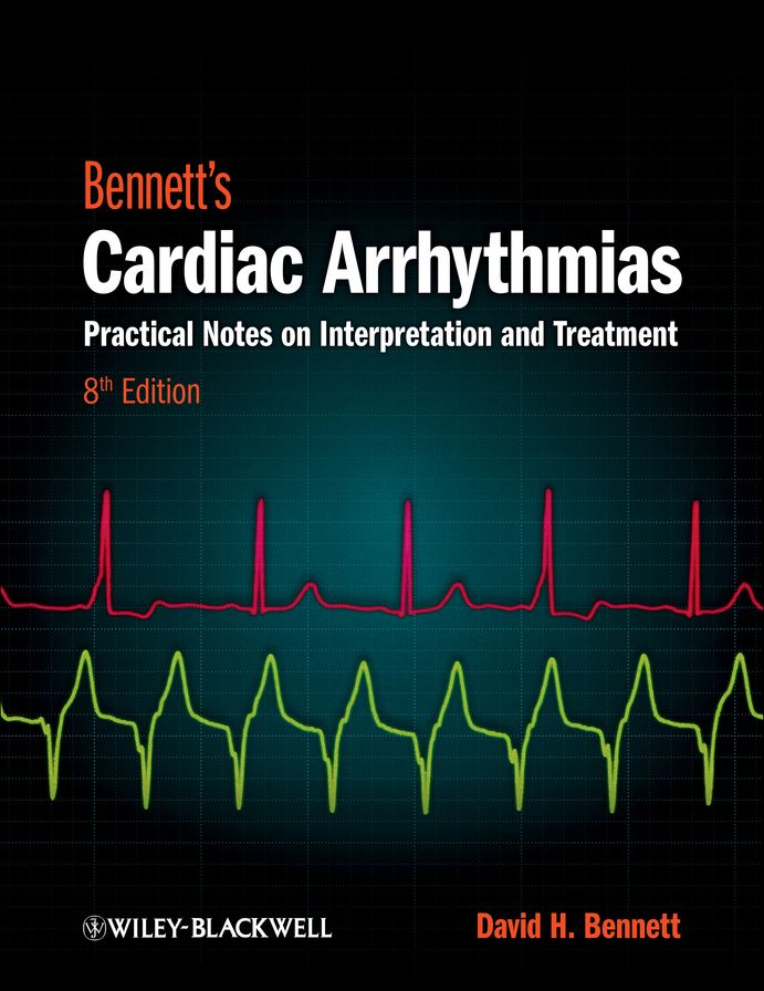Bennett's Cardiac Arrhythmias: Practical Notes on Interpretation and Treatment