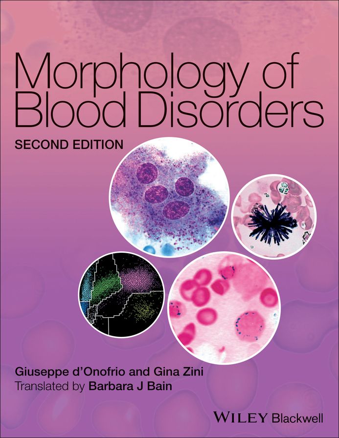 Morphology of Blood Disorders