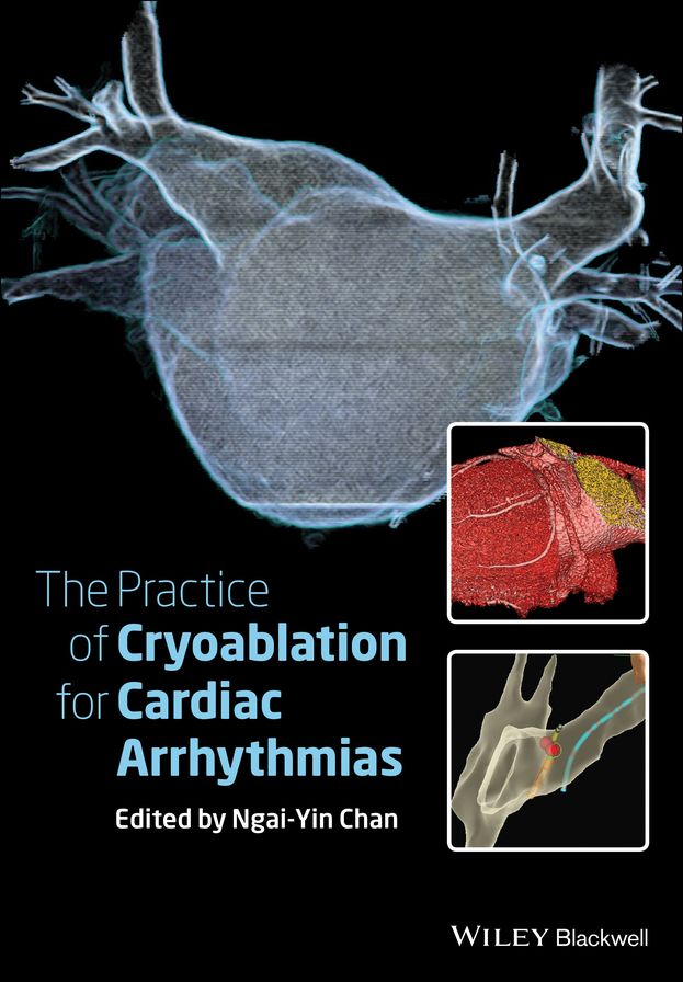 The Practice of Catheter Cryoablation for Cardiac Arrhythmias, Enhanced Edition