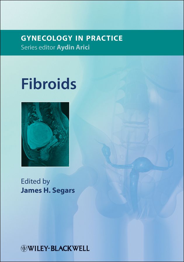 Fibroids