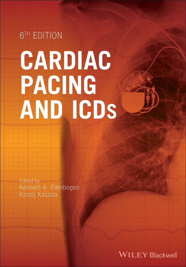 Cardiac Pacing and ICDs