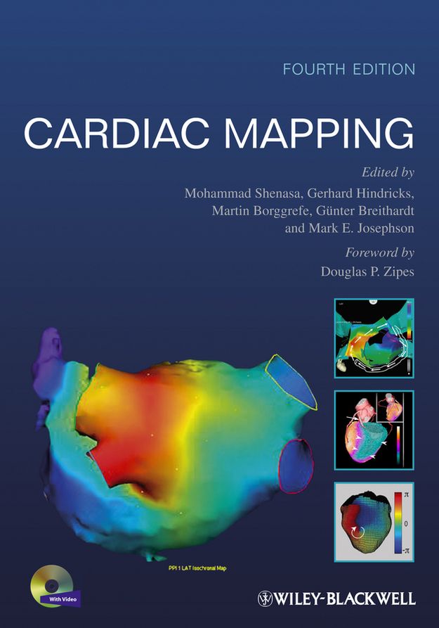 Cardiac Mapping