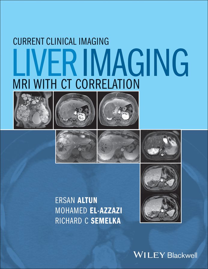 Liver Imaging: MRI with CT Correlation