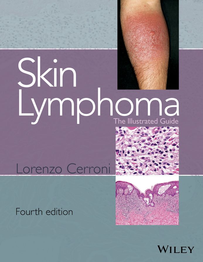 Skin Lymphoma: The Illustrated Guide