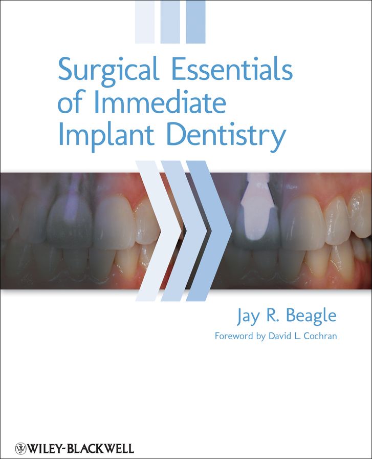 Surgical Essentials of Immediate Implant Dentistry