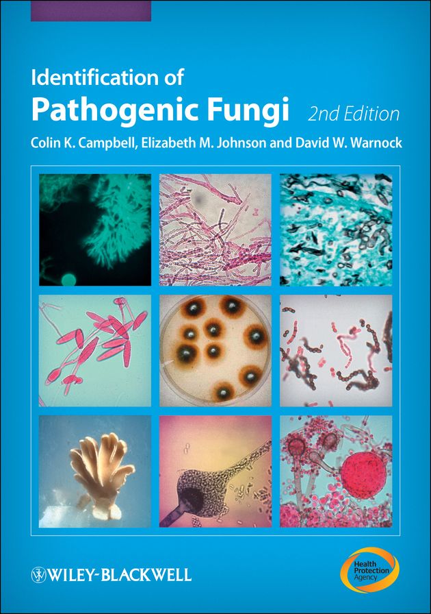 Identification of Pathogenic Fungi