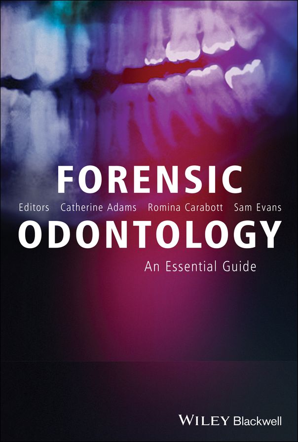 Forensic Odontology: An Essential Guide