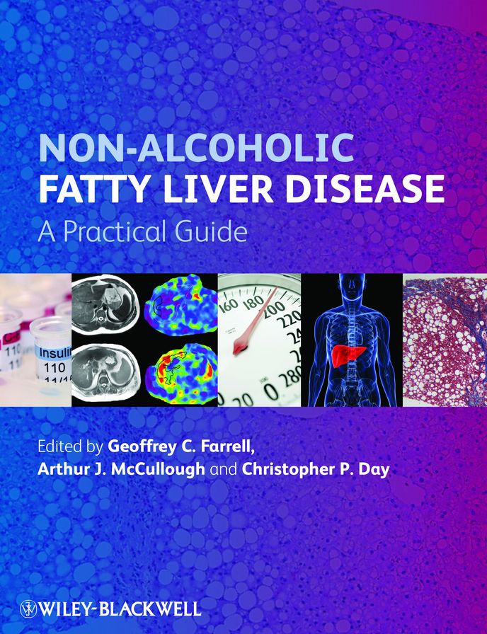 Non-Alcoholic Fatty Liver Disease: A Practical Guide