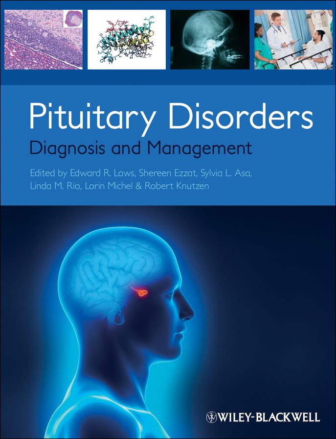 Pituitary Disorders: Diagnosis and Management