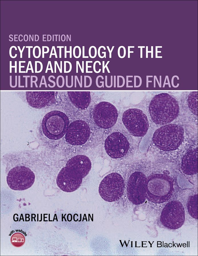 Cytopathology of the Head and Neck: Ultrasound Guided FNAC