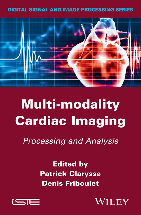 Multi-modality Cardiac Imaging: Processing and Analysis
