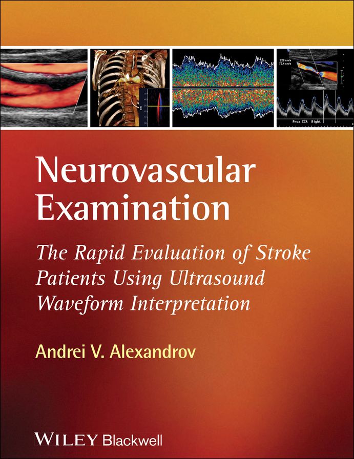 Neurovascular Examination: The Rapid Evaluation of Stroke Patients Using Ultrasound Waveform Interpretation