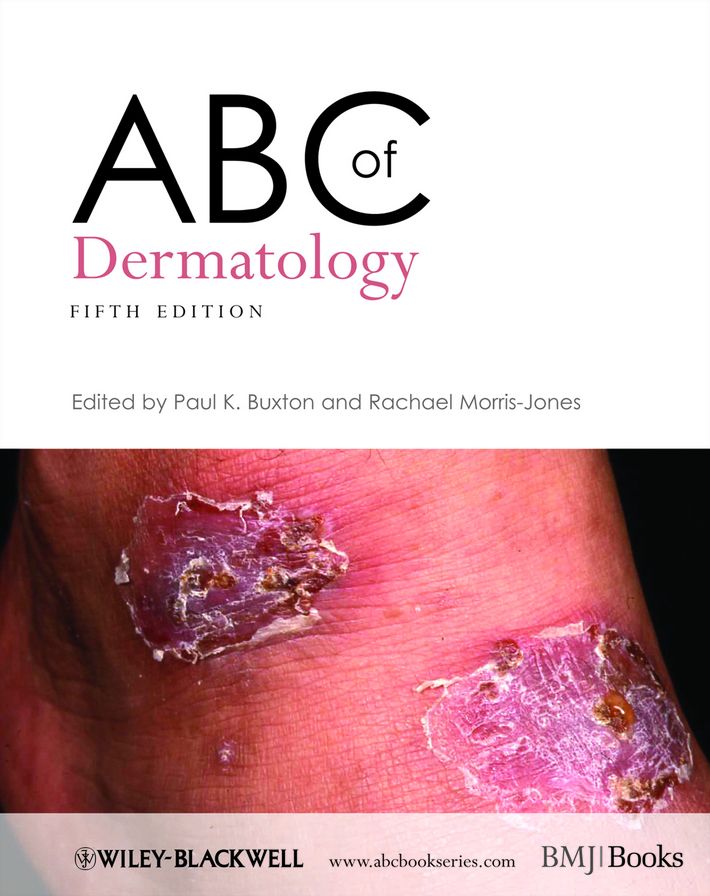 ABC of Dermatology