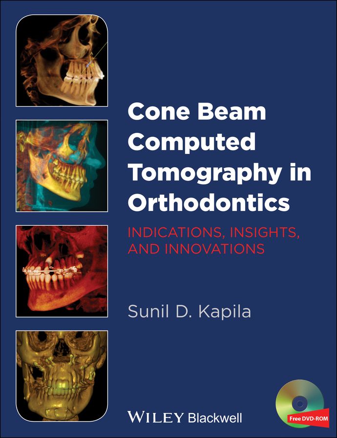 Cone Beam Computed Tomography in Orthodontics: Indications, Insights, and Innovations