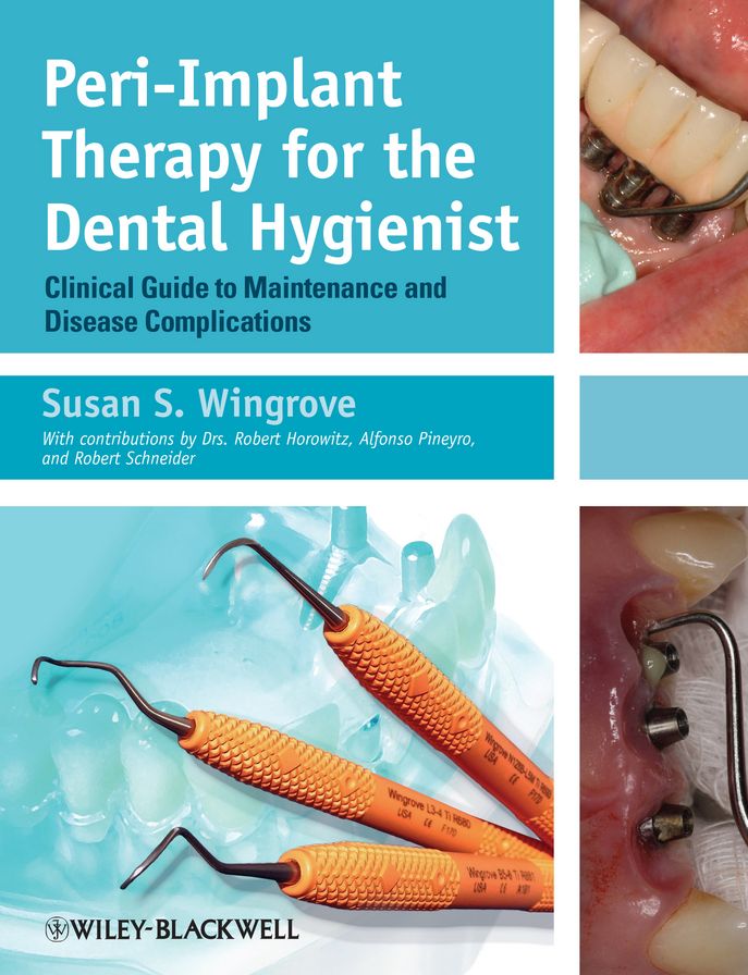 Peri-Implant Therapy for the Dental Hygienist: Clinical Guide to Maintenance and Disease Complications