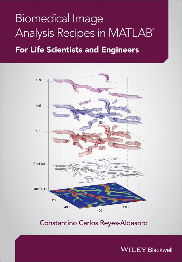 Biomedical Image Analysis Recipes in MATLAB: For Life Scientists and Engineers