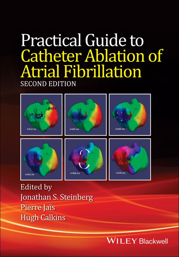 Practical Guide to Catheter Ablation of Atrial Fibrillation