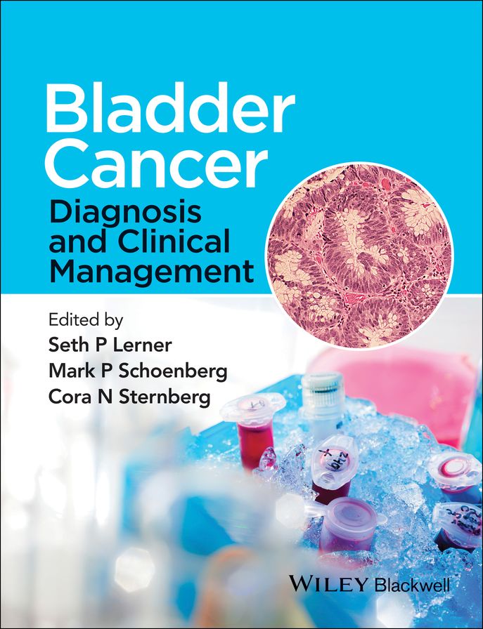 Bladder Cancer: Diagnosis and Clinical Management