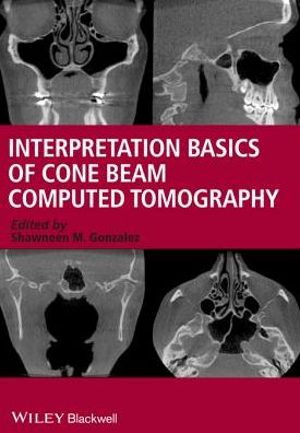 Interpretation Basics of Cone Beam Computed Tomography