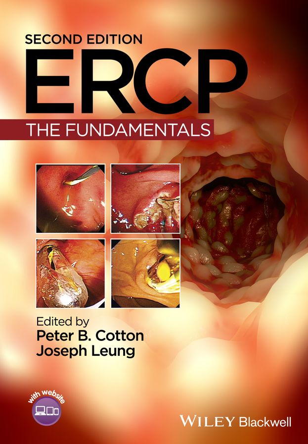 ERCP: The Fundamentals
