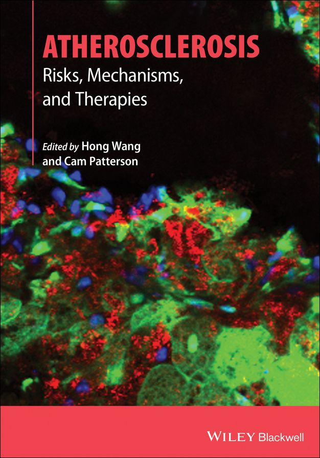 Atherosclerosis: Risks, Mechanisms, and Therapies