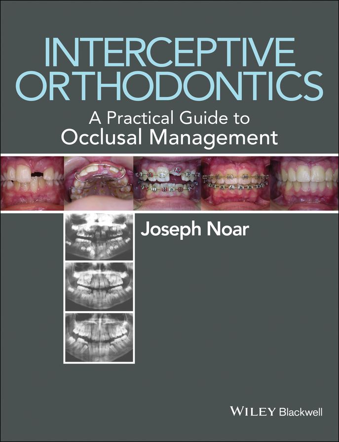Interceptive Orthodontics: A Practical Guide to Occlusal Management