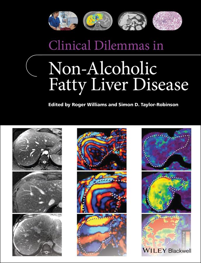 Clinical Dilemmas in Non-Alcoholic Fatty Liver Disease