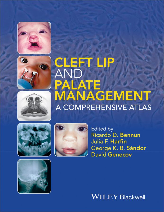 Cleft Lip and Palate Management: A Comprehensive Atlas