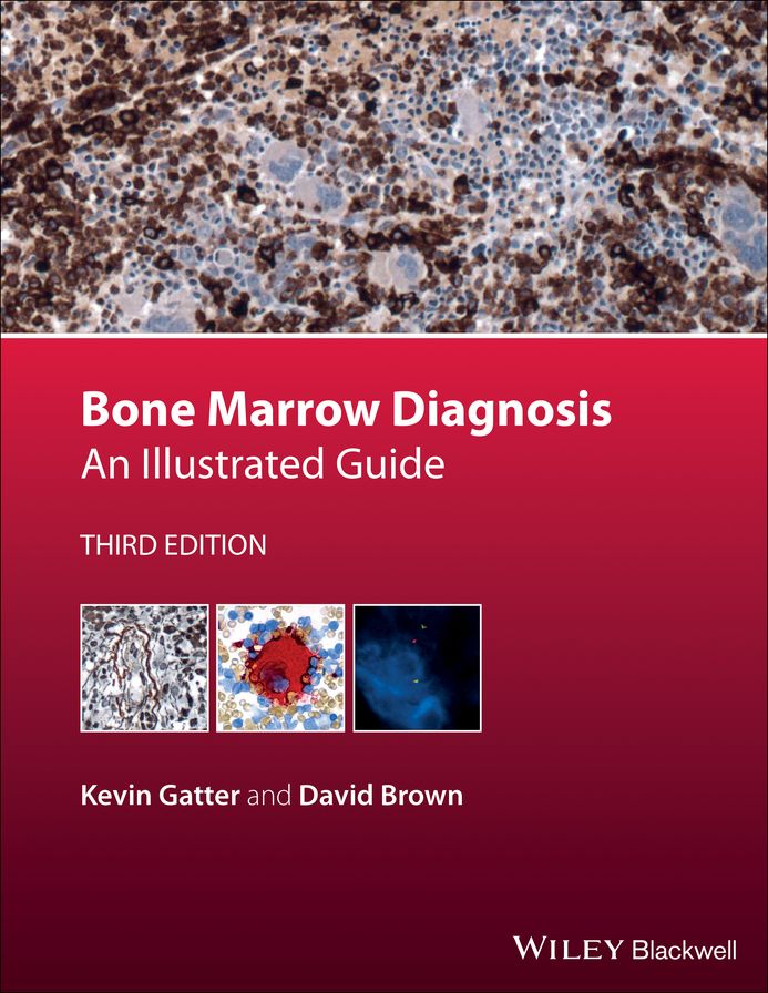 Bone Marrow Diagnosis: An Illustrated Guide