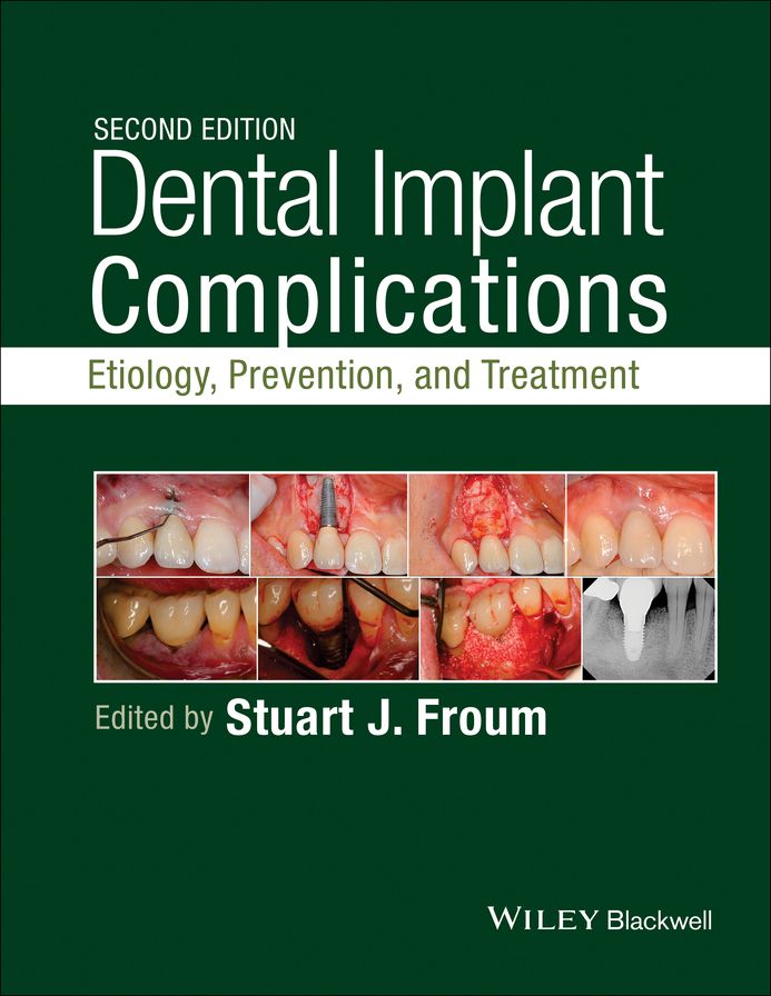 Dental Implant Complications: Etiology, Prevention, and Treatment