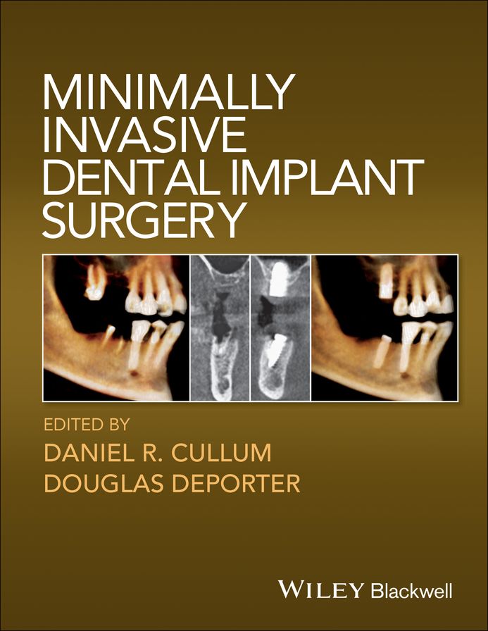 Minimally Invasive Dental Implant Surgery