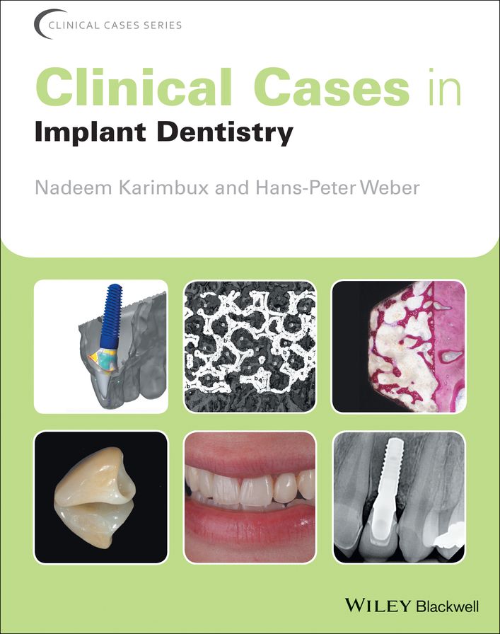 Clinical Cases in Implant Dentistry