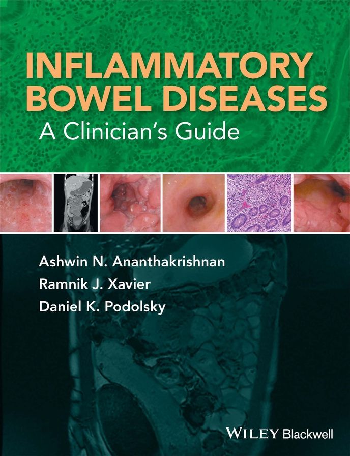 Inflammatory Bowel Diseases: A Clinician's Guide