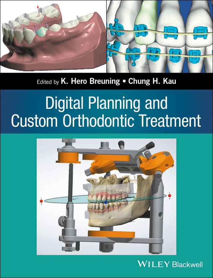 3.1 - Digital Planning and Custom Orthodontic Treatment