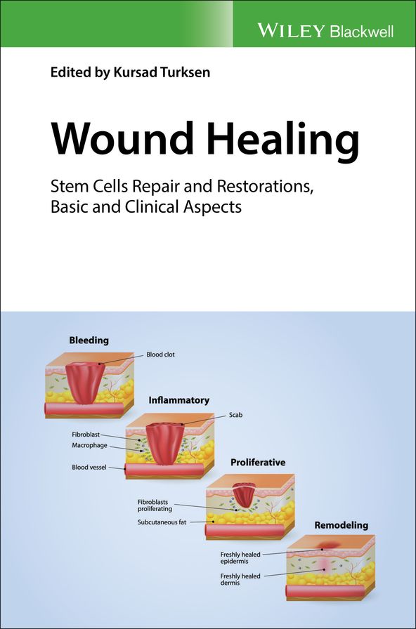 Wound Healing: Stem Cells Repair and Restorations, Basic and Clinical Aspects