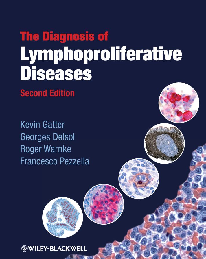 The Diagnosis of Lymphoproliferative Diseases