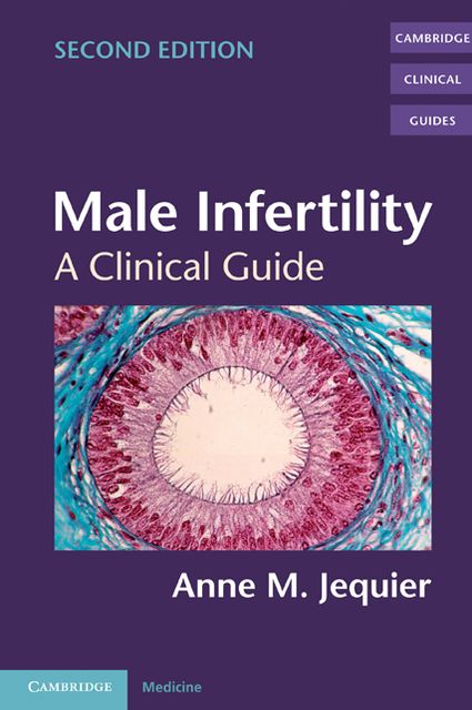 Male Infertility: A Clinical Guide