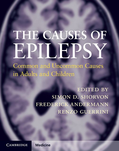 The Causes of Epilepsy: Common and Uncommon Causes in Adults and Children