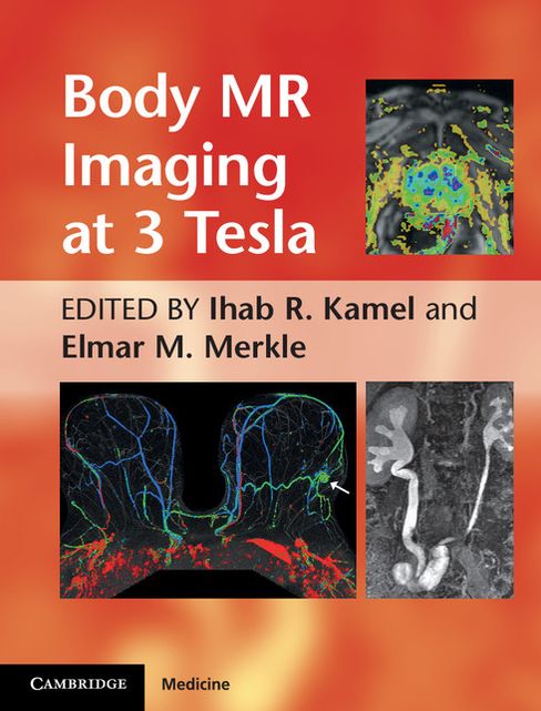 Body MR Imaging at 3 Tesla