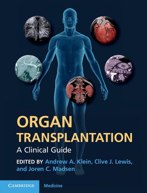 Organ Transplantation: A Clinical Guide