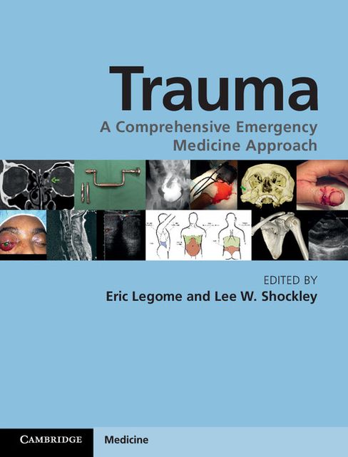 Trauma: A Comprehensive Emergency Medicine Approach
