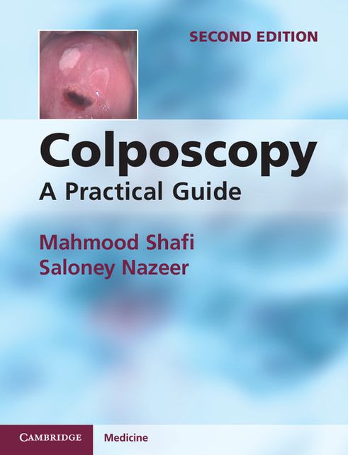Colposcopy: A Practical Guide