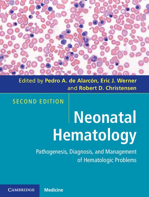 Neonatal Hematology: Pathogenesis, Diagnosis, and Management of Hematologic Problems