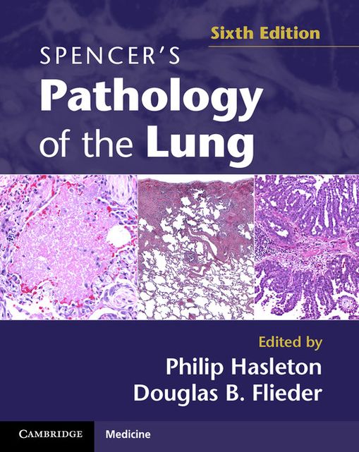 Spencer's Pathology of the Lung