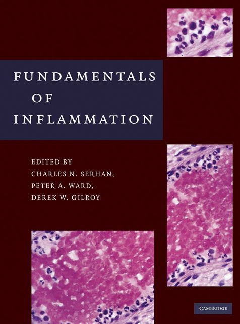 Fundamentals of Inflammation