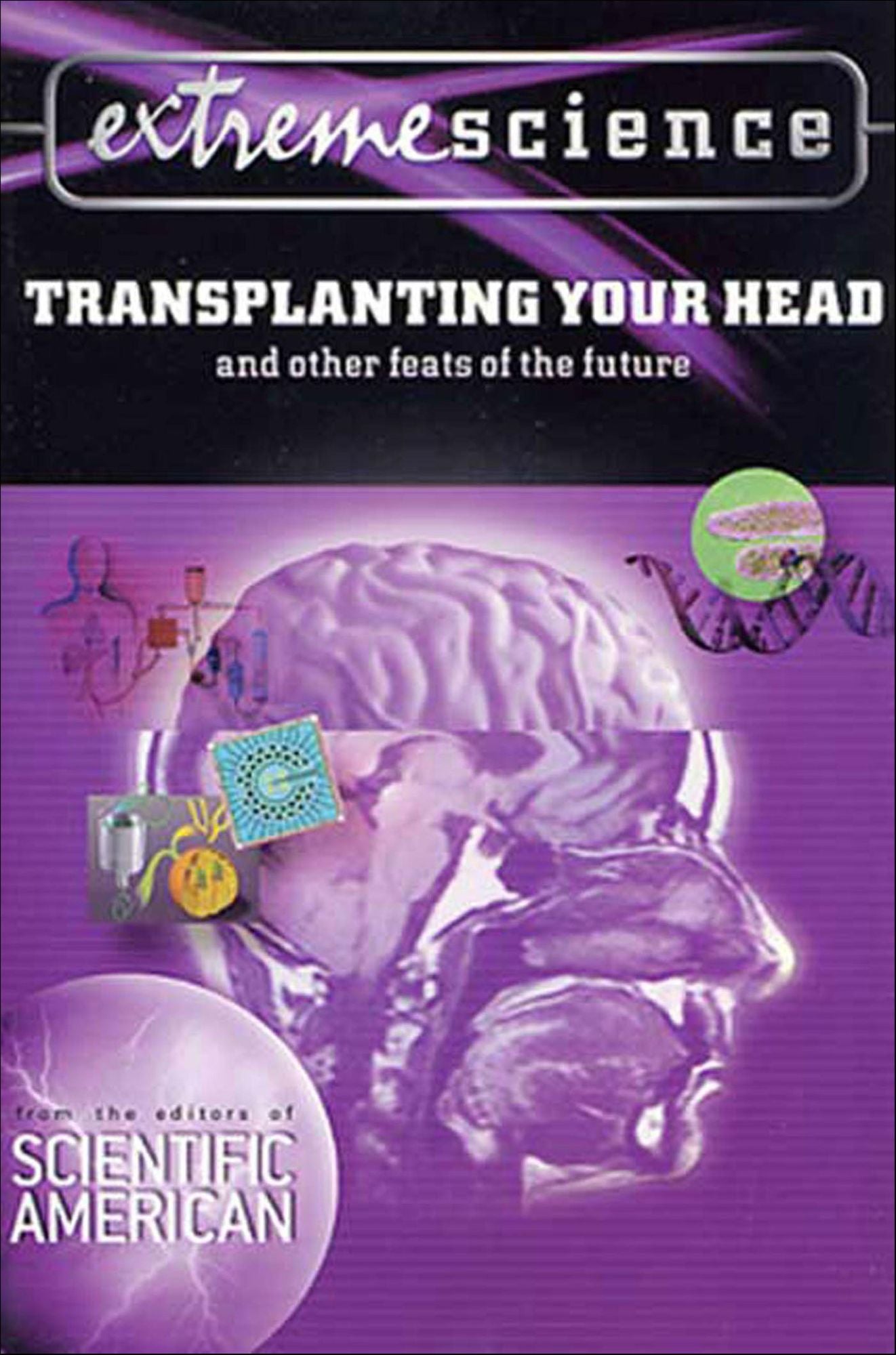 Extreme Science: Transplanting Your Head: And Other Feats of the Future
