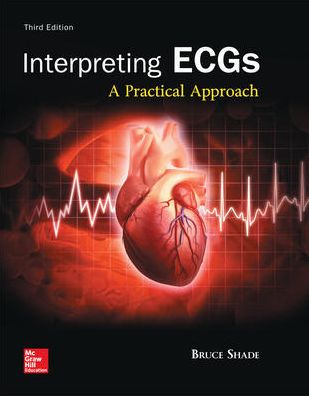 Fast and Easy ECGs: Self-Paced Learning Prog